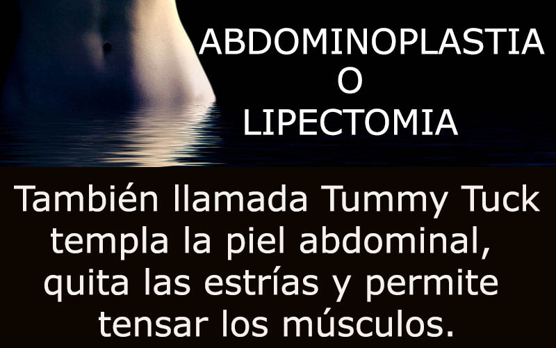 abdominoplastia boton